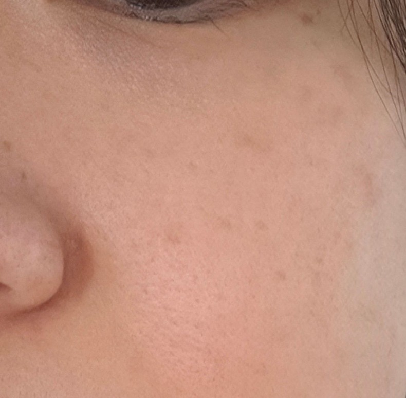 After